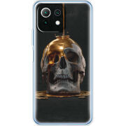 Чехол BoxFace Xiaomi Mi 11 Lite 