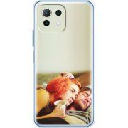 Чехол BoxFace Xiaomi Mi 11 Lite 