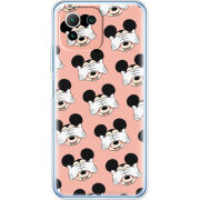 Чехол BoxFace Xiaomi Mi 11 Lite 