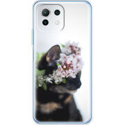 Чехол BoxFace Xiaomi Mi 11 Lite 