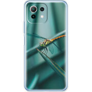 Чехол BoxFace Xiaomi Mi 11 Lite 