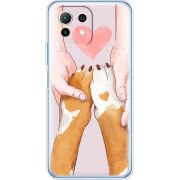 Чехол BoxFace Xiaomi Mi 11 Lite 