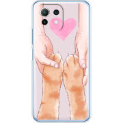 Чехол BoxFace Xiaomi Mi 11 Lite 