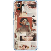 Чехол BoxFace Xiaomi Mi 11 Lite 