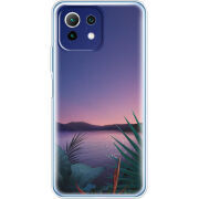 Чехол BoxFace Xiaomi Mi 11 Lite 