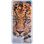 Чехол BoxFace Xiaomi Mi 11 Lite 