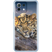 Чехол BoxFace Xiaomi Mi 11 Lite 