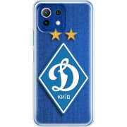 Чехол BoxFace Xiaomi Mi 11 Lite Динамо Киев