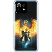 Чехол BoxFace Xiaomi Mi 11 Lite 