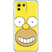 Чехол BoxFace Xiaomi Mi 11 Lite 