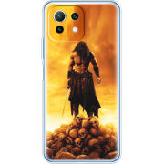 Чехол BoxFace Xiaomi Mi 11 Lite 