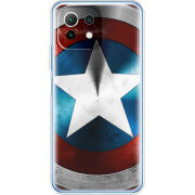 Чехол BoxFace Xiaomi Mi 11 Lite 