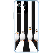 Чехол BoxFace Xiaomi Mi 11 Lite 