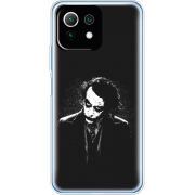 Чехол BoxFace Xiaomi Mi 11 Lite 