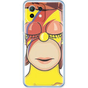 Чехол BoxFace Xiaomi Mi 11 Lite 