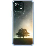 Чехол BoxFace Xiaomi Mi 11 Lite 