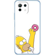 Чехол BoxFace Xiaomi Mi 11 Lite 