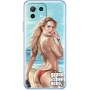 Чехол BoxFace Xiaomi Mi 11 Lite 