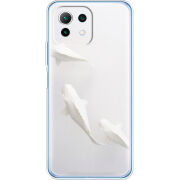 Чехол BoxFace Xiaomi Mi 11 Lite 