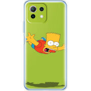 Чехол BoxFace Xiaomi Mi 11 Lite 