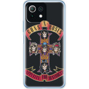 Чехол BoxFace Xiaomi Mi 11 Lite 