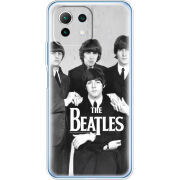 Чехол BoxFace Xiaomi Mi 11 Lite 