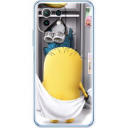 Чехол BoxFace Xiaomi Mi 11 Lite 