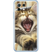 Чехол BoxFace Xiaomi Mi 11 Lite 