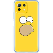 Чехол BoxFace Xiaomi Mi 11 Lite 