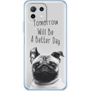 Чехол BoxFace  Xiaomi 11 Lite 5G NE 