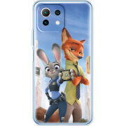 Чехол BoxFace  Xiaomi 11 Lite 5G NE 