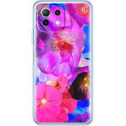 Чехол BoxFace  Xiaomi 11 Lite 5G NE 