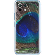 Чехол BoxFace  Xiaomi 11 Lite 5G NE 