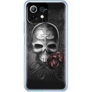 Чехол BoxFace  Xiaomi 11 Lite 5G NE 