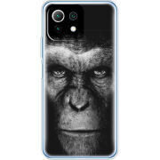 Чехол BoxFace  Xiaomi 11 Lite 5G NE 