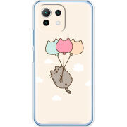 Чехол BoxFace  Xiaomi 11 Lite 5G NE 