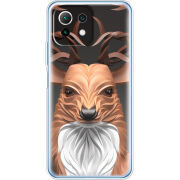 Чехол BoxFace  Xiaomi 11 Lite 5G NE 