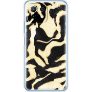 Чехол BoxFace  Xiaomi 11 Lite 5G NE 