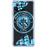 Чехол BoxFace  Xiaomi 11 Lite 5G NE FC M-City