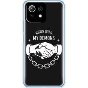 Чехол BoxFace  Xiaomi 11 Lite 5G NE 