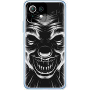 Чехол BoxFace  Xiaomi 11 Lite 5G NE 