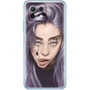 Чехол BoxFace  Xiaomi 11 Lite 5G NE 