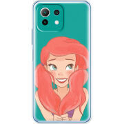Чехол BoxFace  Xiaomi 11 Lite 5G NE 
