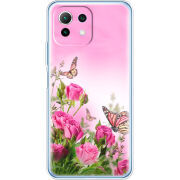 Чехол BoxFace  Xiaomi 11 Lite 5G NE 