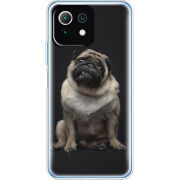 Чехол BoxFace  Xiaomi 11 Lite 5G NE 