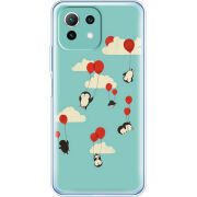 Чехол BoxFace  Xiaomi 11 Lite 5G NE 