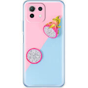 Чехол BoxFace  Xiaomi 11 Lite 5G NE 