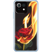 Чехол BoxFace  Xiaomi 11 Lite 5G NE 
