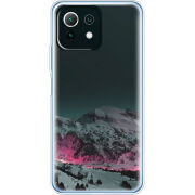 Чехол BoxFace  Xiaomi 11 Lite 5G NE 