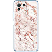 Чехол BoxFace  Xiaomi 11 Lite 5G NE 